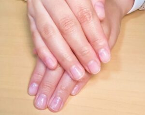 ネイル施術 クリア爪