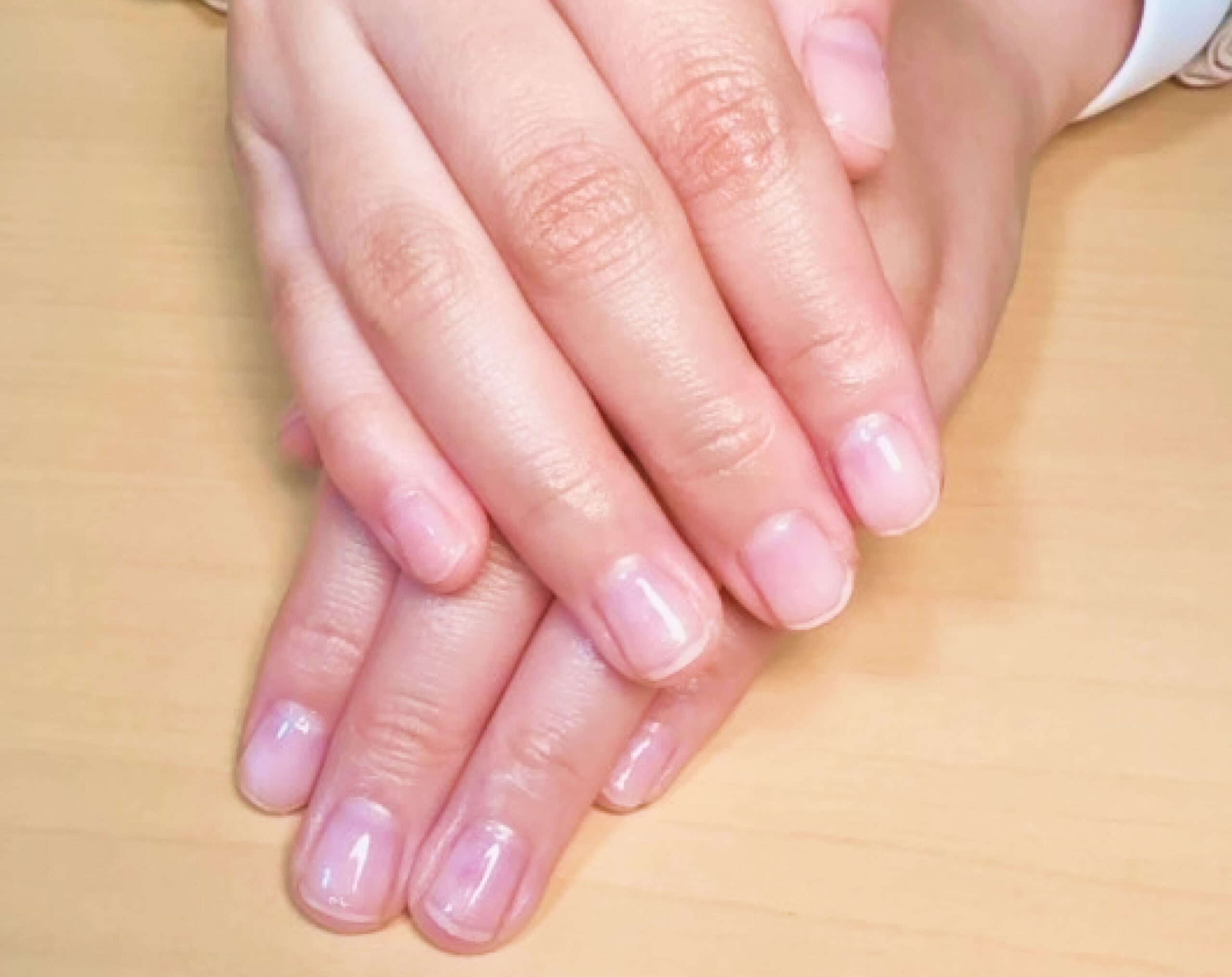 ネイル施術 クリア爪